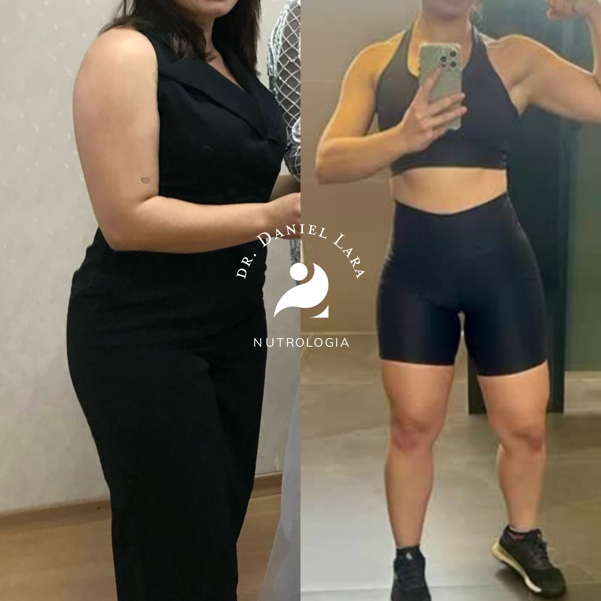 Transformação corporal com tratamento personalizado — antes e depois